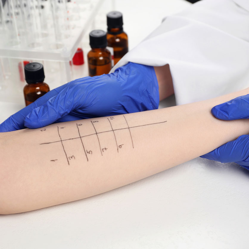AllergyTest(1)