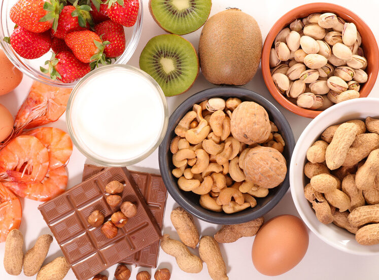 FoodAllergies